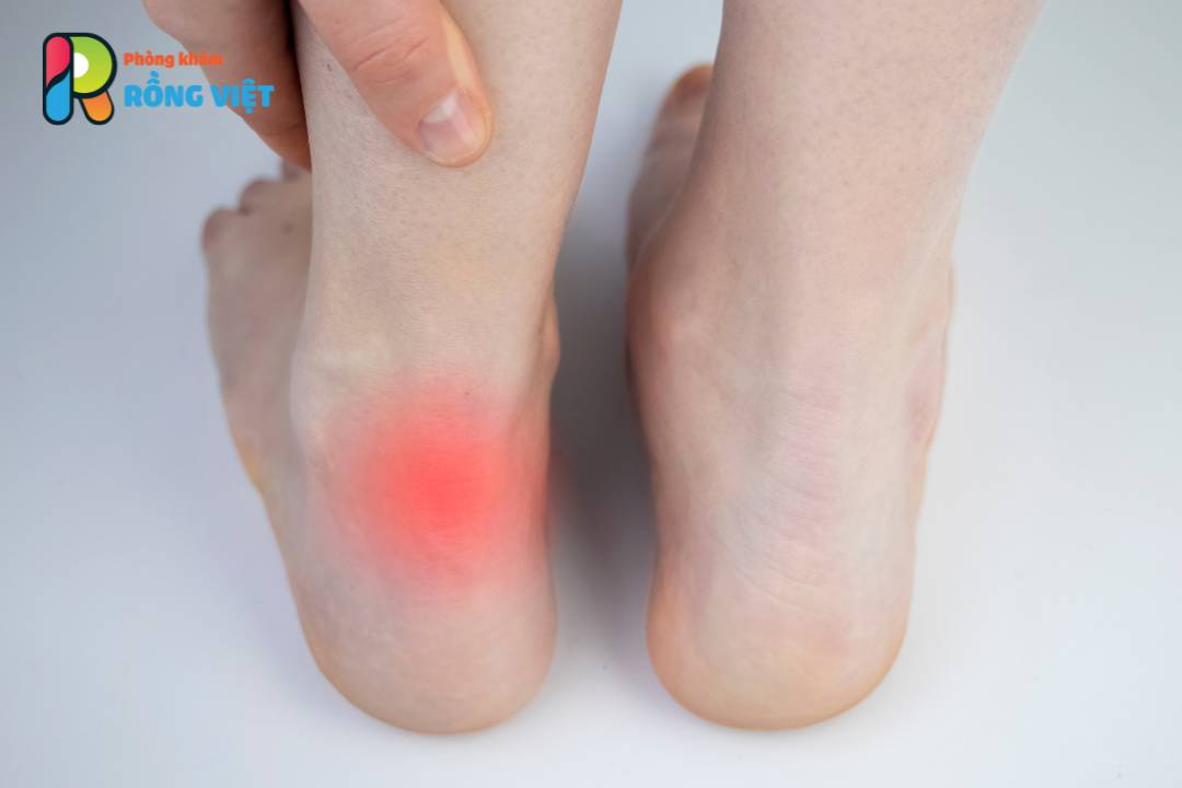phuong phap cap cuu tai cho khi bi thuong 2